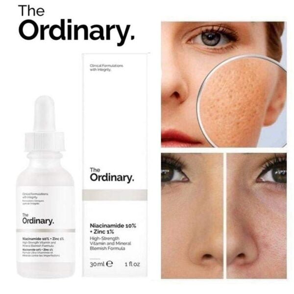 The Ordinary Niacinamide 10 Zinc 1 30ml 1 Alyour.com